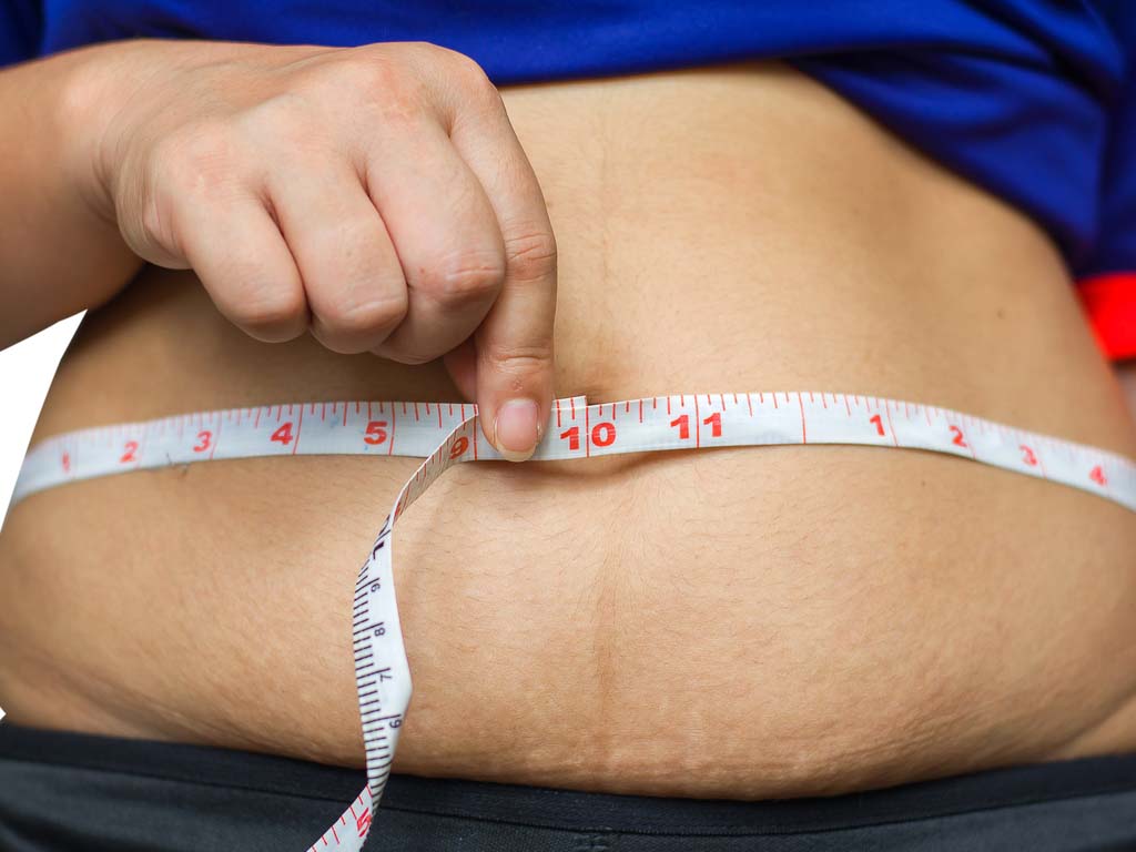 Will Weight Loss Surgery Increase Your Chance of Divorce?